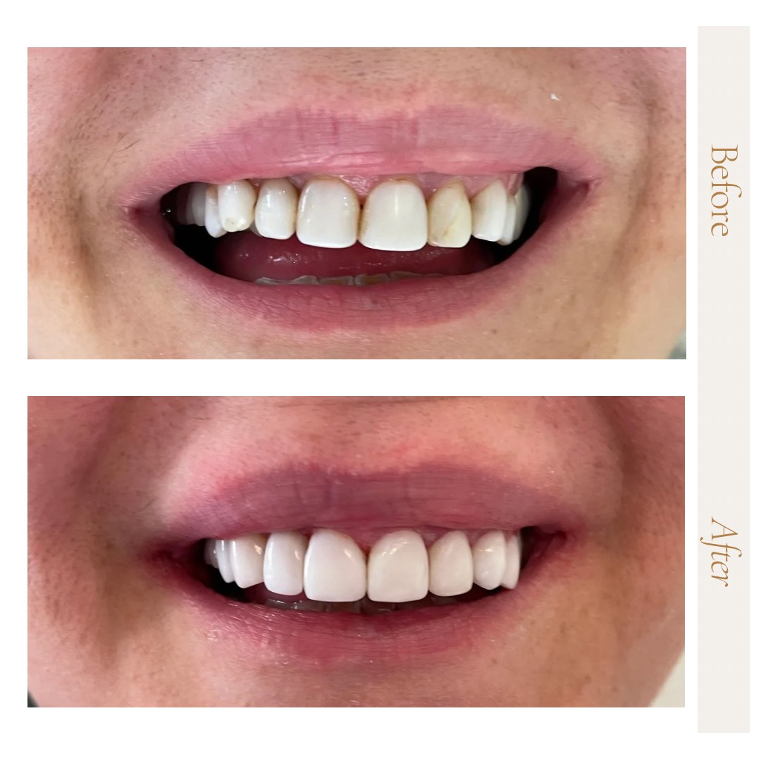 Client - 1