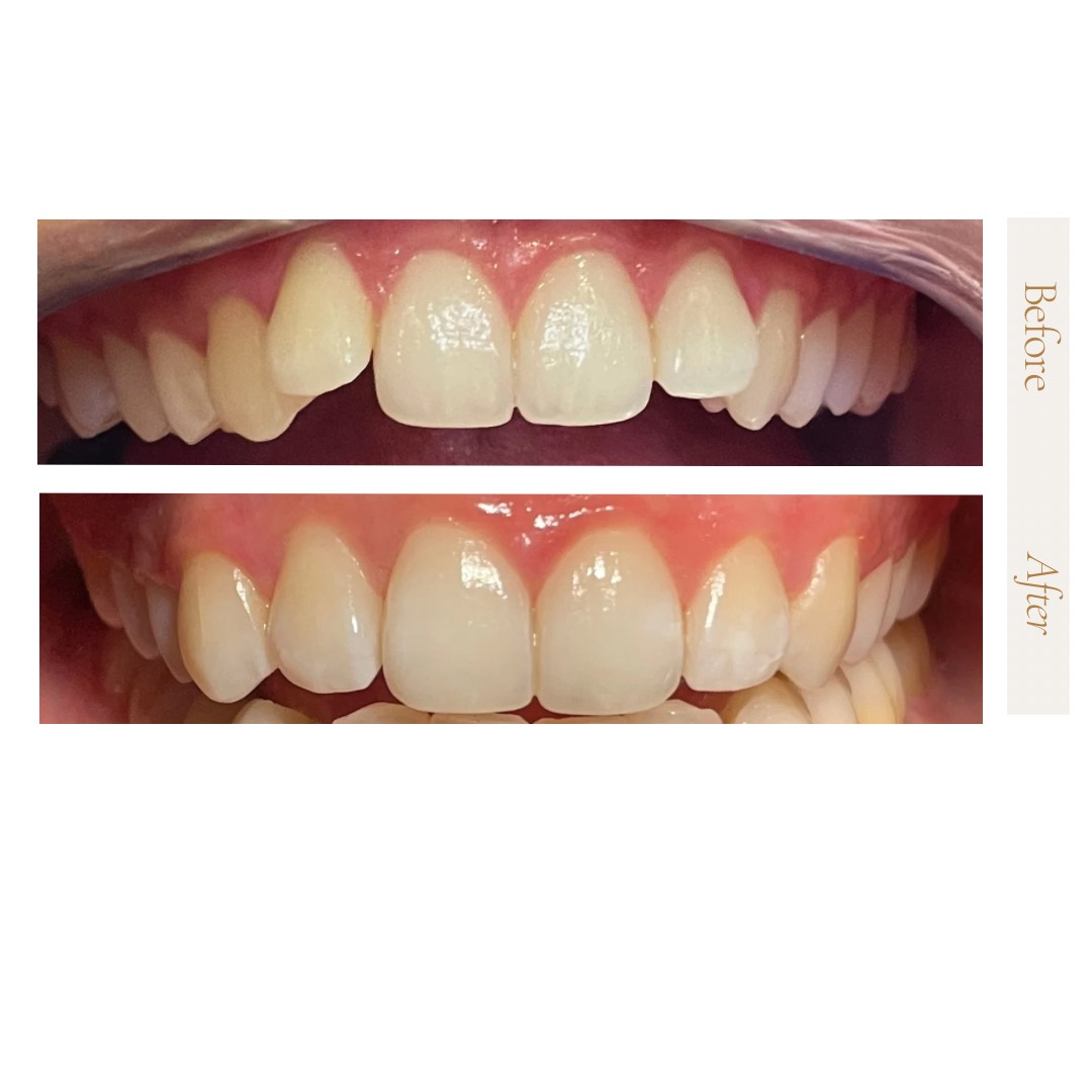 Client